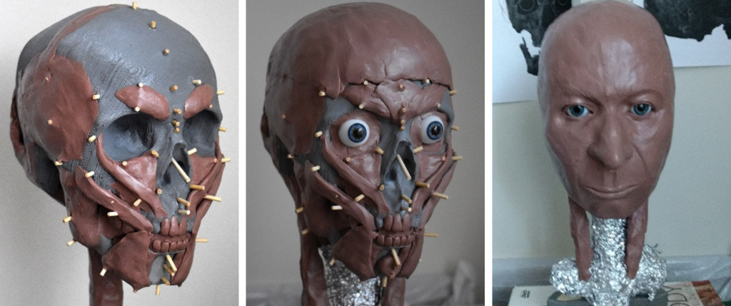 Three different phases of the facial reconstruction 